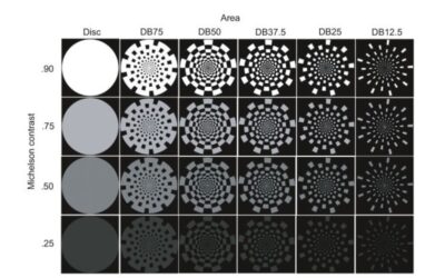 Disrupted brain network functional dynamics and hyper-correlation of structural and functional connectome topology in patients with breast cancer prior to treatment.