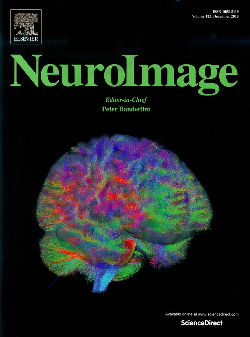 neuroimage