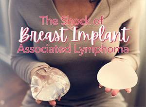 The-Shock-of-breast-implant-associated-lymphoma-300x220